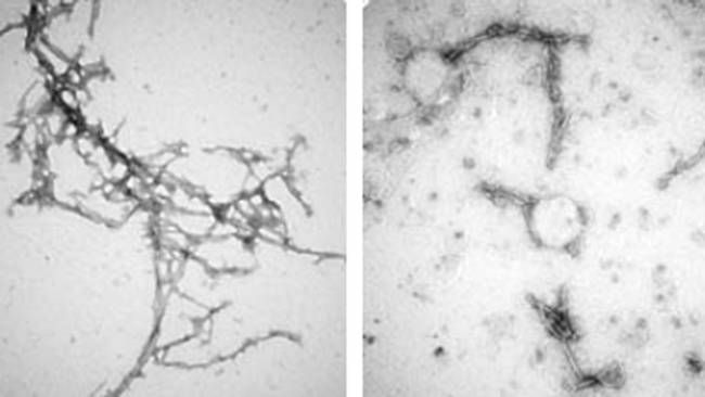 alpha-synuclein clumps