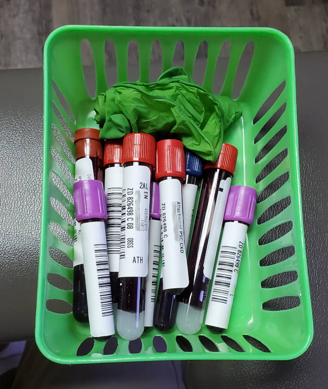 blood draws to test liver, kidney and thyroid function